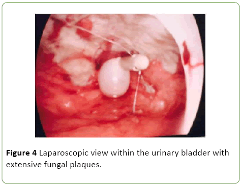 gynecology-obstetrics-Laparoscopic-view