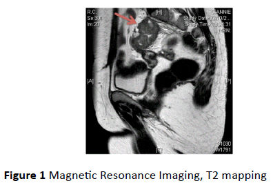 gynecology-obstetrics-Magnetic-Resonance