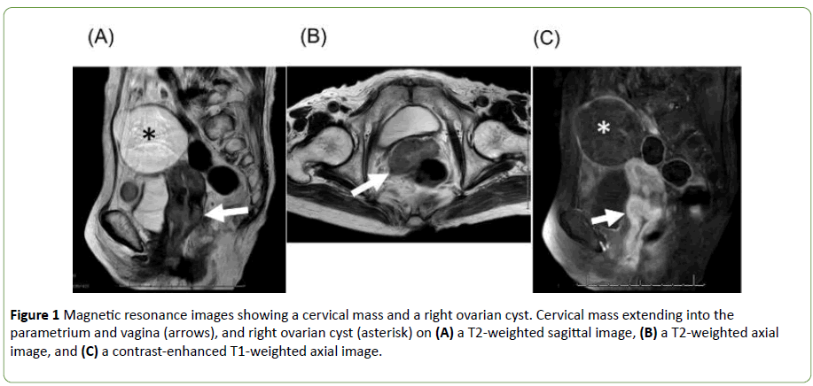 gynecology-obstetrics-Magnetic-resonance