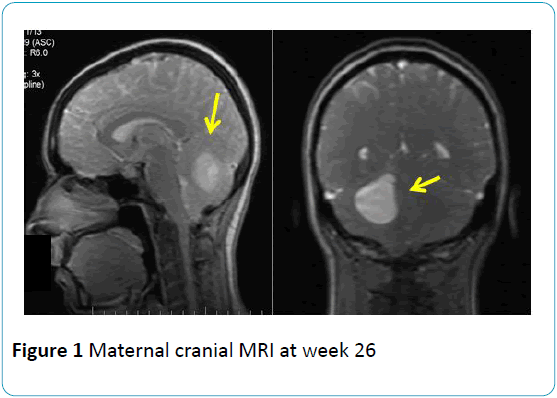 gynecology-obstetrics-Maternal-cranial-MRI
