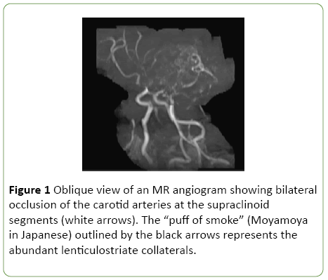 gynecology-obstetrics-Oblique-view