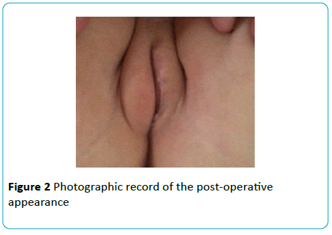 gynecology-obstetrics-Photographic-post-operative