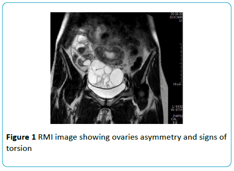 gynecology-obstetrics-RMI-asymmetry-torsion