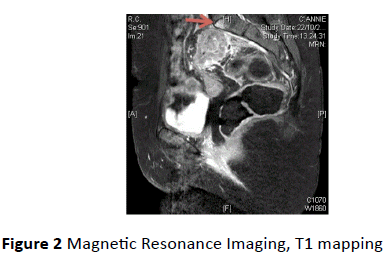 gynecology-obstetrics-Resonance-Imaging