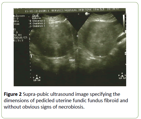 gynecology-obstetrics-Supra-pubic