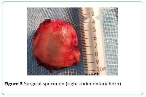 gynecology-obstetrics-Surgical-specimen