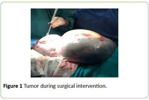 gynecology-obstetrics-Tumor-during-surgical-intervention