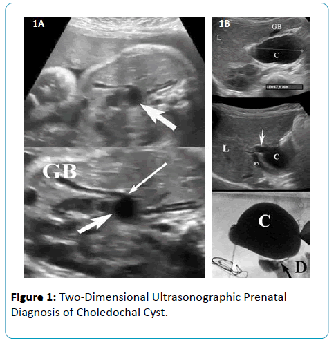 gynecology-obstetrics-Two-Dimensional-Ultrasonographic