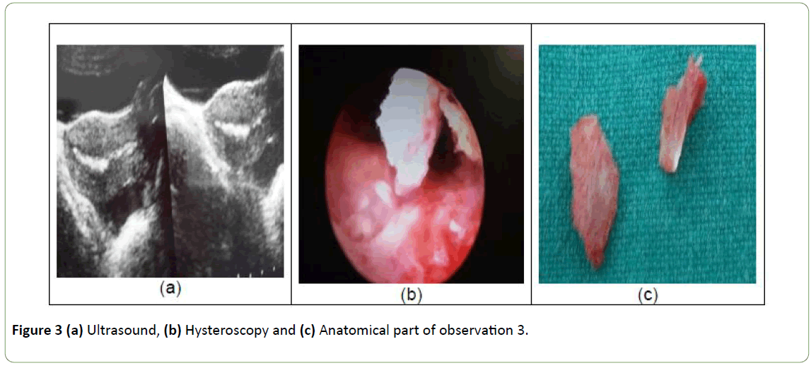 gynecology-obstetrics-Ultrasound