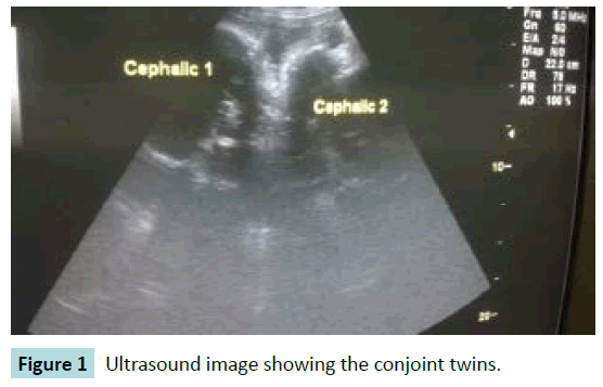 gynecology-obstetrics-Ultrasound-image