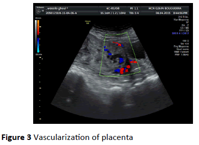 gynecology-obstetrics-Vascularization