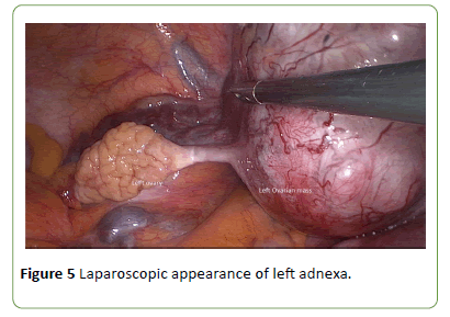 gynecology-obstetrics-adnexa