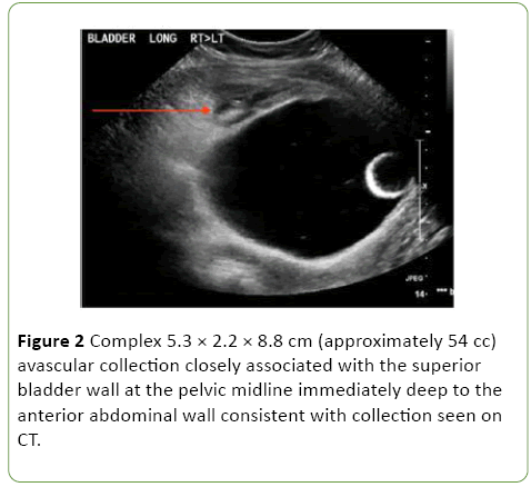 gynecology-obstetrics-avascular-collection