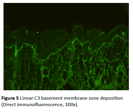 gynecology-obstetrics-basement-membrane