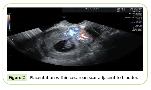 gynecology-obstetrics-bladder