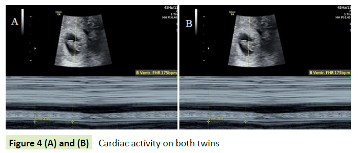 gynecology-obstetrics-cardiac-activity