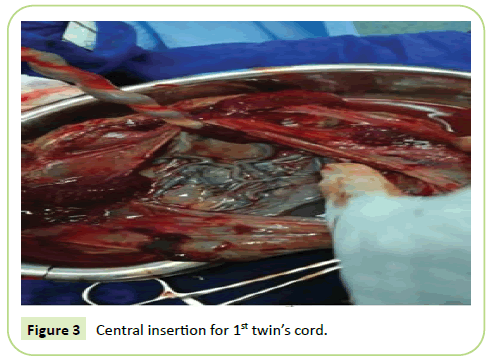 gynecology-obstetrics-central-insertion