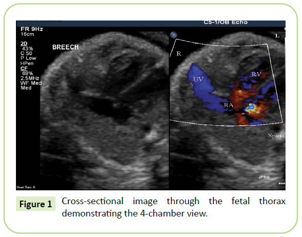 gynecology-obstetrics-chamber-view