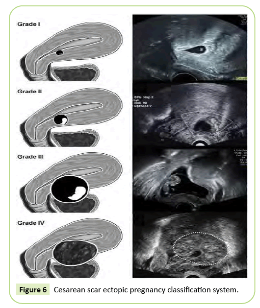 gynecology-obstetrics-classification