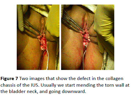 gynecology-obstetrics-collagen-chassis