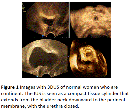 gynecology-obstetrics-compact-tissue-cylinder