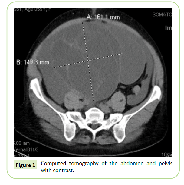 gynecology-obstetrics-contrast