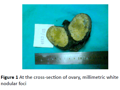 gynecology-obstetrics-cross-section