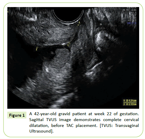 gynecology-obstetrics-demonstrates