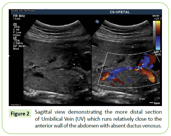 gynecology-obstetrics-distal-section