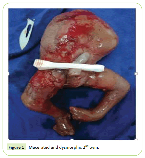 gynecology-obstetrics-dysmorphic