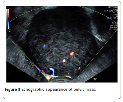 gynecology-obstetrics-echographic