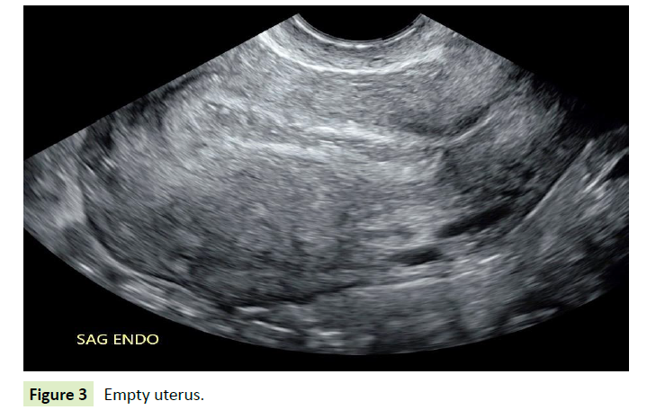 gynecology-obstetrics-empty-uterus