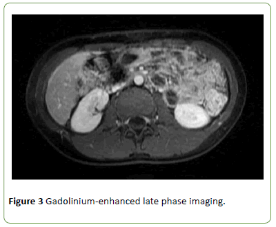 gynecology-obstetrics-gadolinium