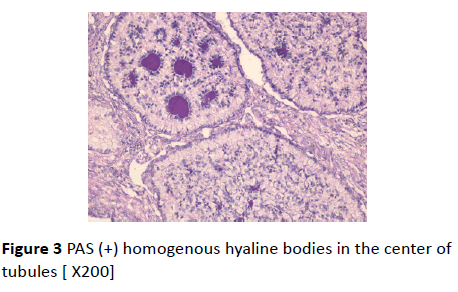 gynecology-obstetrics-homogenous-hyaline