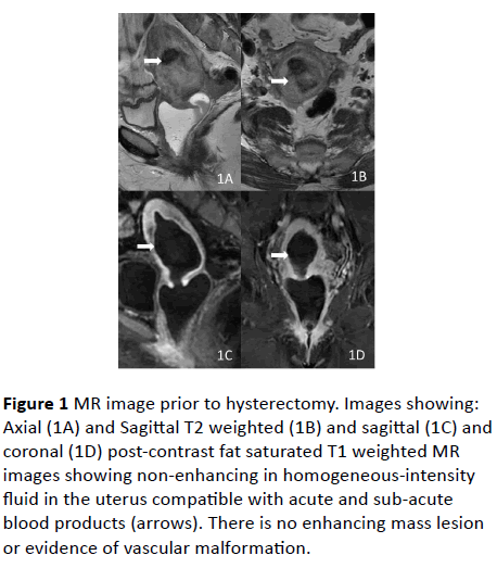 gynecology-obstetrics-image-prior-hysterectomy