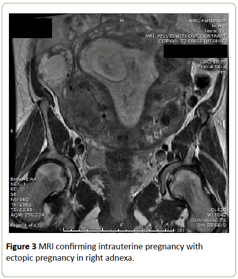 gynecology-obstetrics-intrauterine-pregnancy