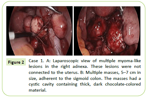 gynecology-obstetrics-laparoscopic-view