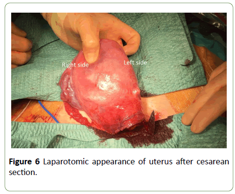 gynecology-obstetrics-laparotomic