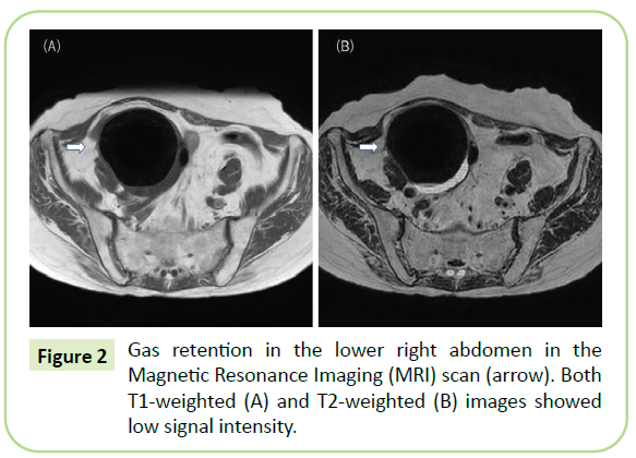 gynecology-obstetrics-magnetic-resonance