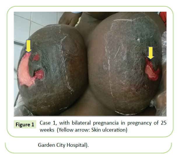 gynecology-obstetrics-mucinous