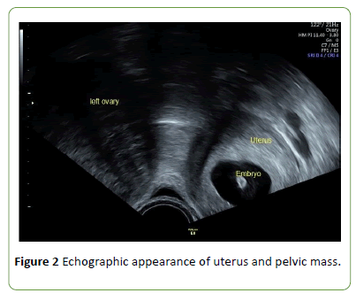 gynecology-obstetrics-pelvic