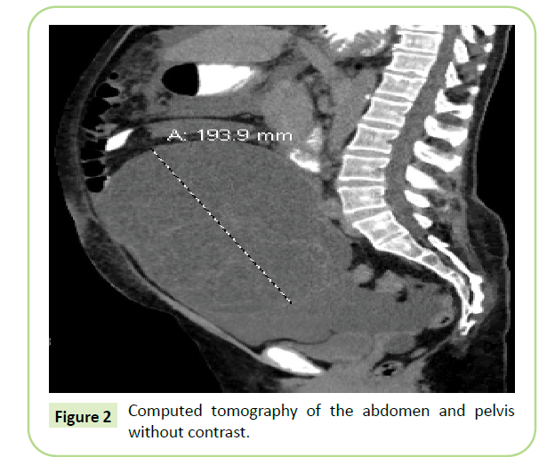 gynecology-obstetrics-pelvis