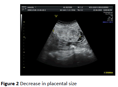 gynecology-obstetrics-placental-size