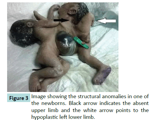 gynecology-obstetrics-structural-anomalies