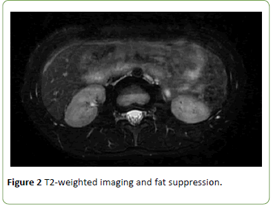 gynecology-obstetrics-suppression