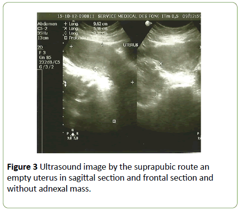 gynecology-obstetrics-suprapubic-route