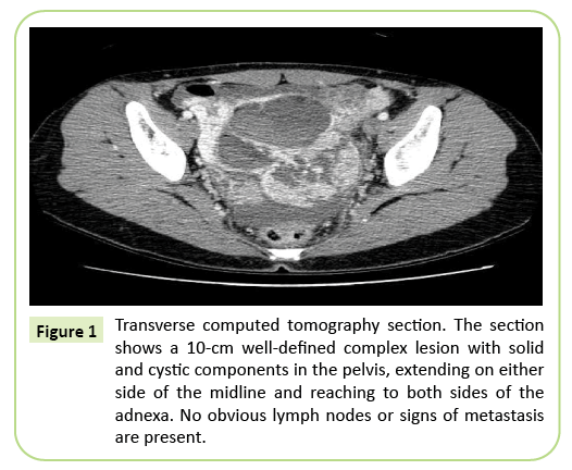 gynecology-obstetrics-tomography