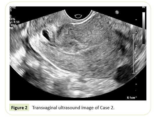 gynecology-obstetrics-transvaginal