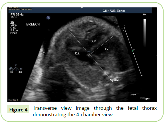 gynecology-obstetrics-transverse-view