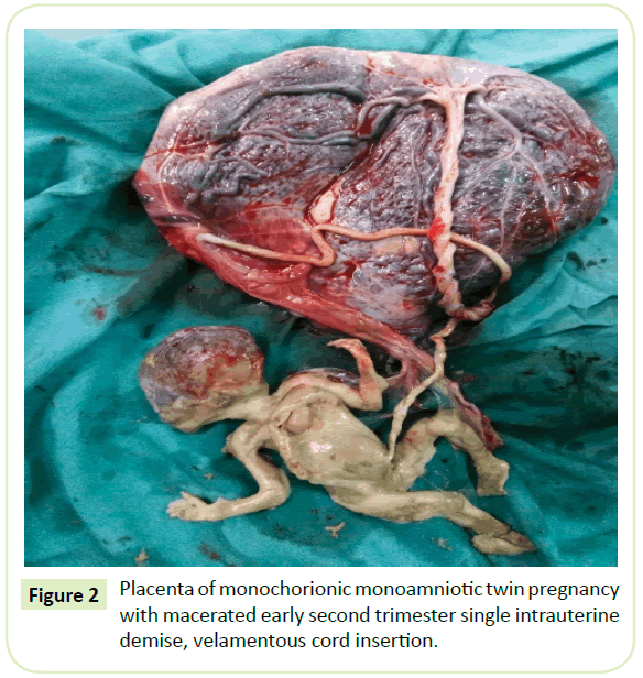 gynecology-obstetrics-trimester